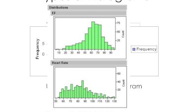 Data Representation with Various Types of Histograms
